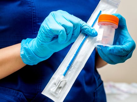 A doctor in a medical setting holding up a swab and sample obtained from a pap smear. The doctor is wearing medical gloves, demonstrating proper healthcare protocols for diagnostic testing and patient care.