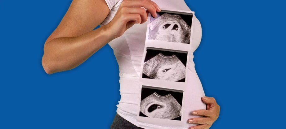 snapshot of an ultrasound twin in the fourth week of pregnancy-2