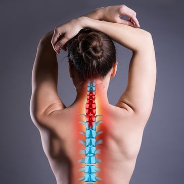 woman with Severe back pain